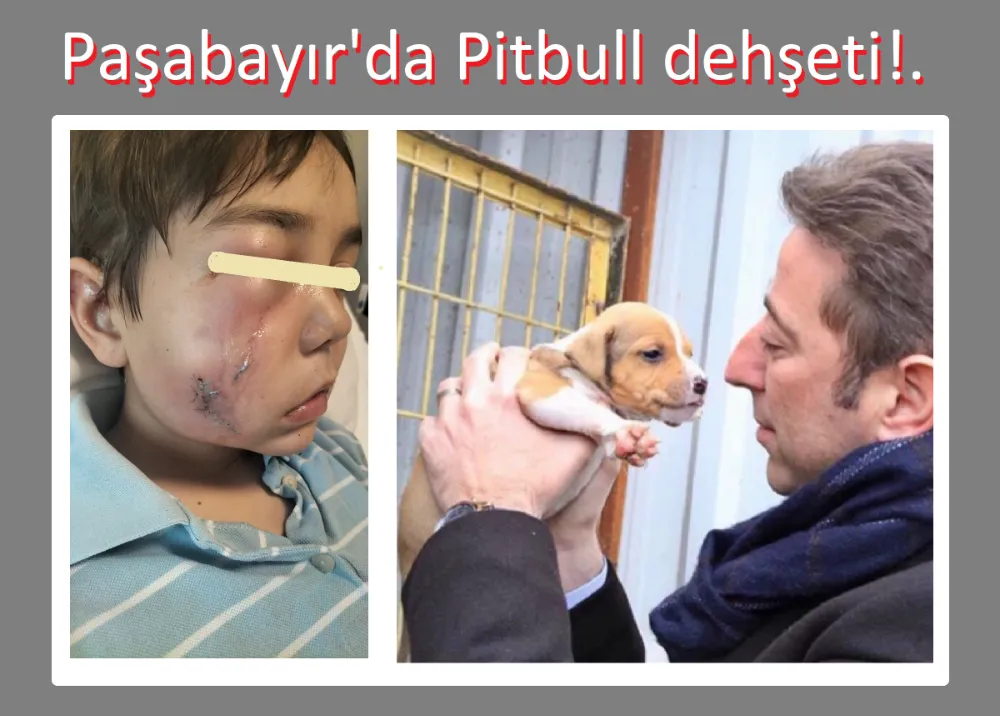 Başkan’ın Pitbull’u çocuk parçaladı.